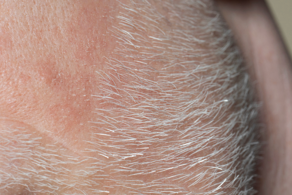 Can Damaged Hair Follicles Be Restored?