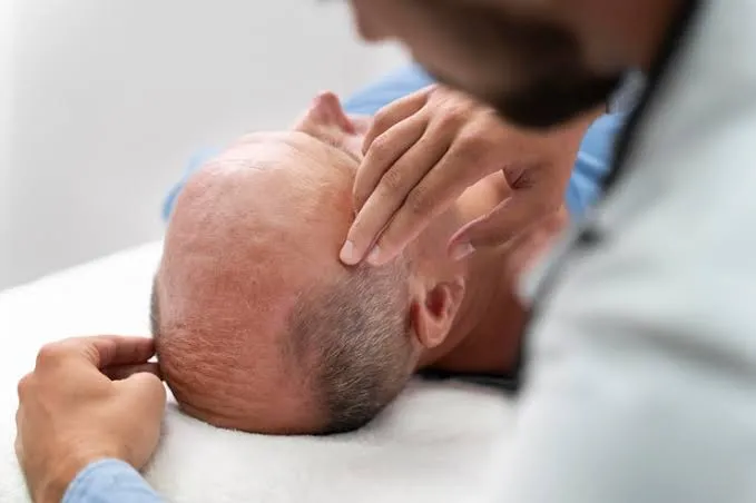 Frontal Fibrosing Alopecia: Symptoms, Causes & Treatment